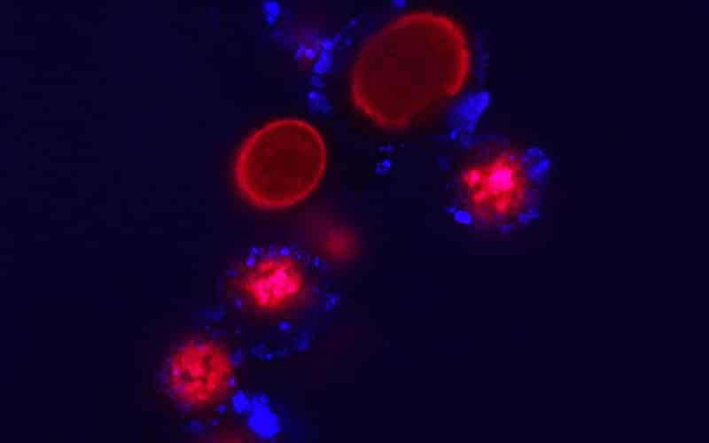 SnowAlgae-11-web Snow algae cells viewed with a microscopy